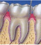 periodontal.html