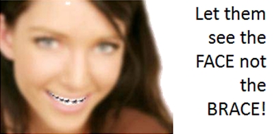 braces to invisalign